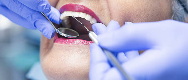 Best Emergency Tooth Extraction in Ata, OK